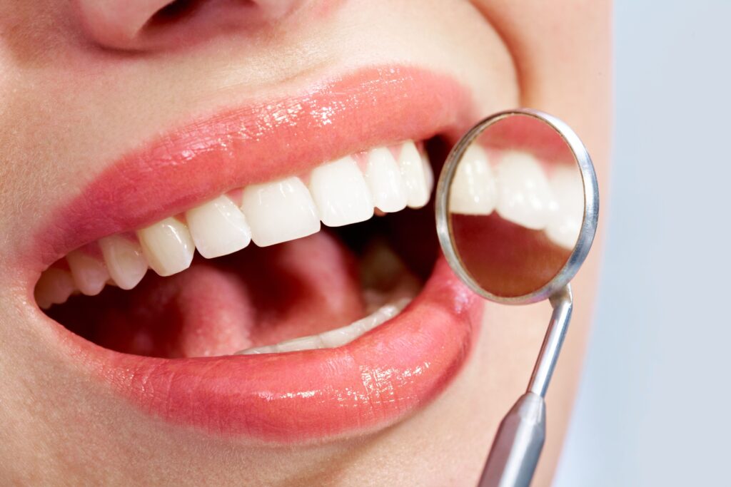 Blanqueamiento dental en Santander y Solares