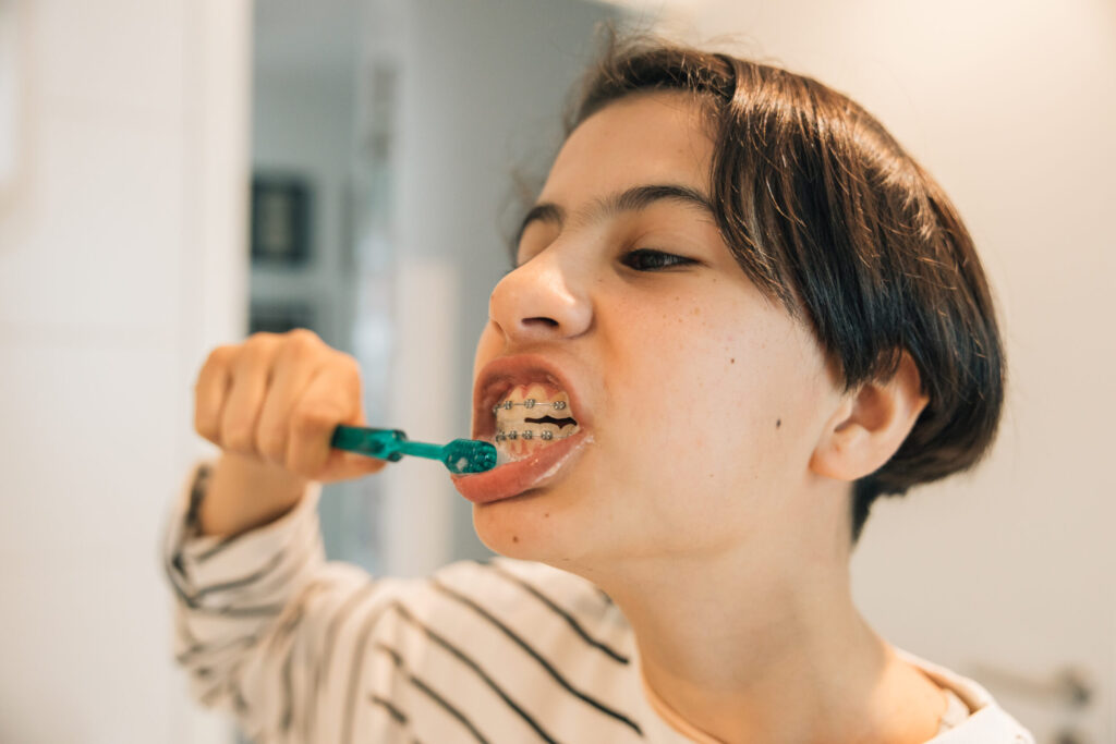 higiene oral brackets